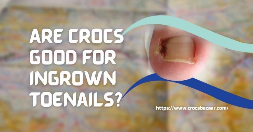 are-crocs-good-for-ingrown-toenails-researcher-s-opinion